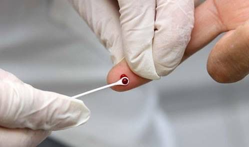 Campanha do Ministério da Saúde incentiva testagem para diagnóstico precoce das hepatites no Brasil